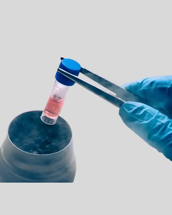 Best Egg & Sperm freezing, Donor egg or sperm – Dr. Prodduturu Padmaja